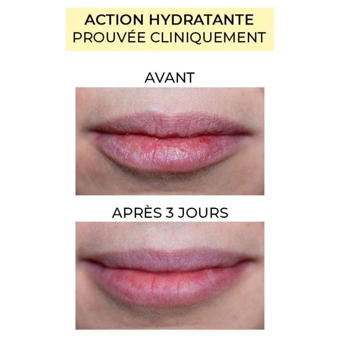 SOIN - AVANT / APRÈS