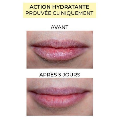 AVANT / APRÈS